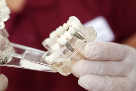 Implantate von der Zahnarztpraxis Lohmann in Moers